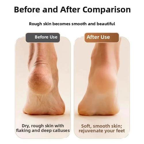 电动磨脚器新款去死皮老茧修脚神器家用修足机自动刮脚打磨器