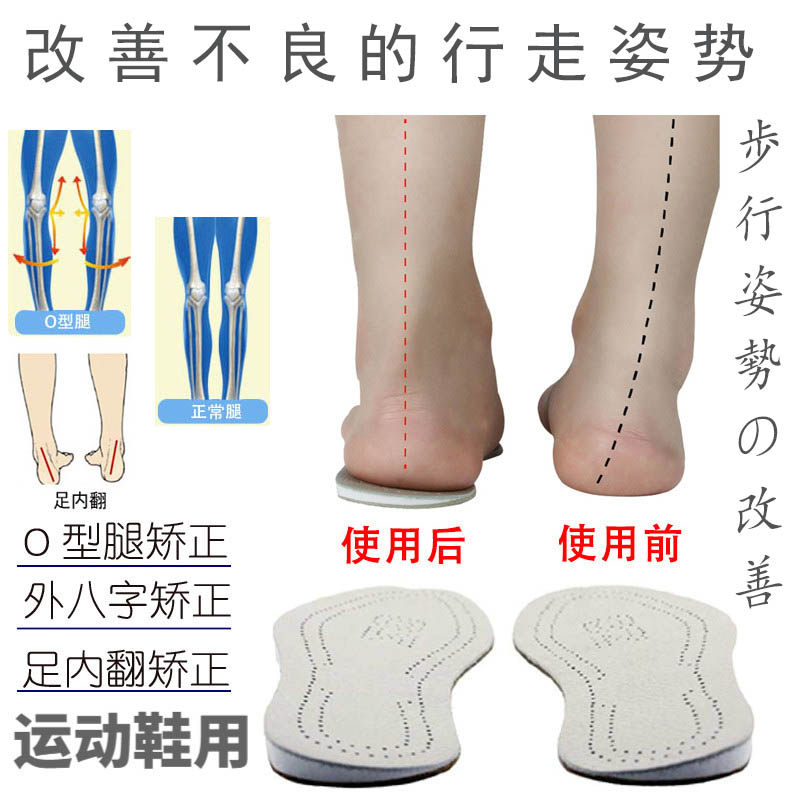日本O型腿矫正鞋垫矫正足内翻外八字脚纠正鞋垫男女通用双面牛皮
