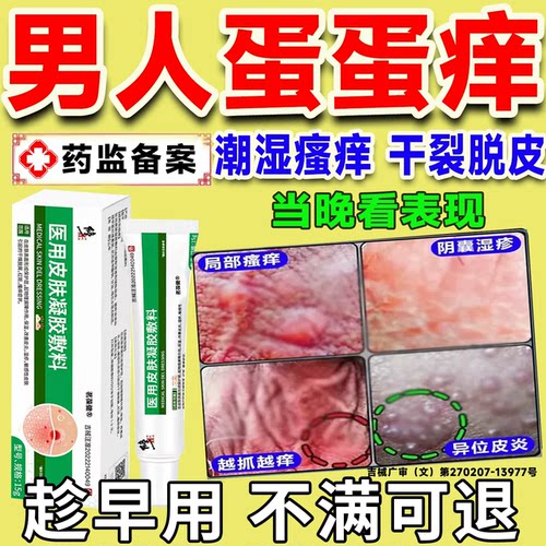 阴囊潮湿瘙痒湿红疹肿真菌感染