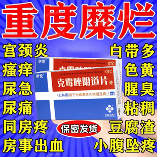 妇科炎症霉菌性阴道炎宫颈糜烂专用妇科用药二度三度克霉唑阴道片