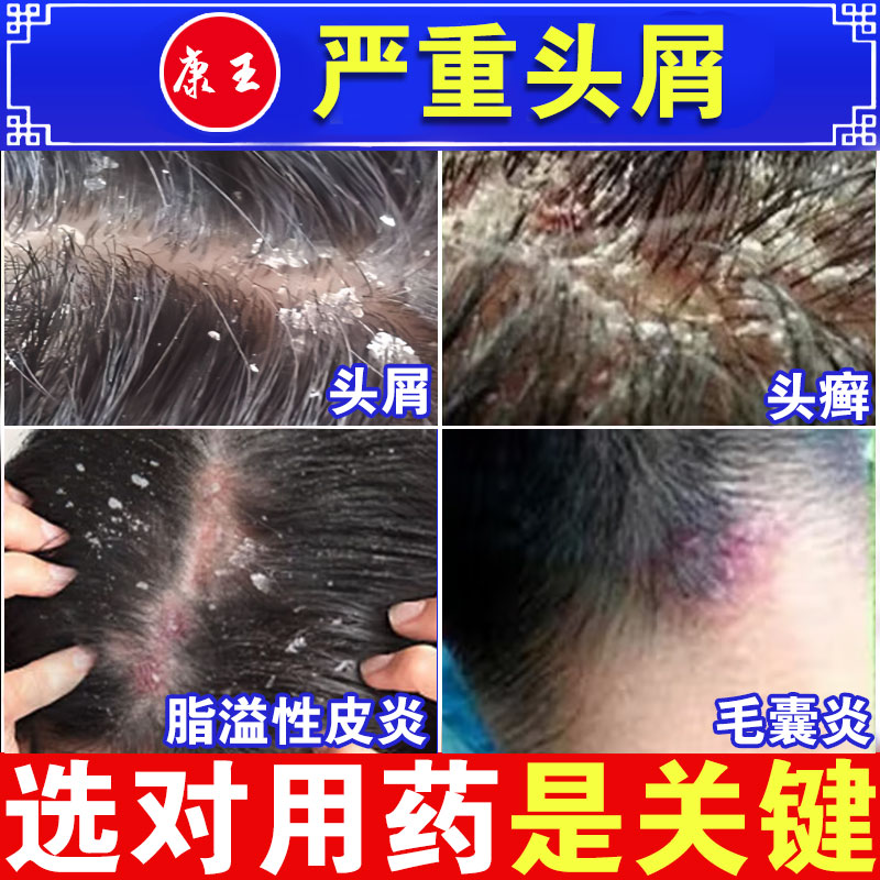 【康王】酮康唑洗剂2%*50ml*1瓶/盒