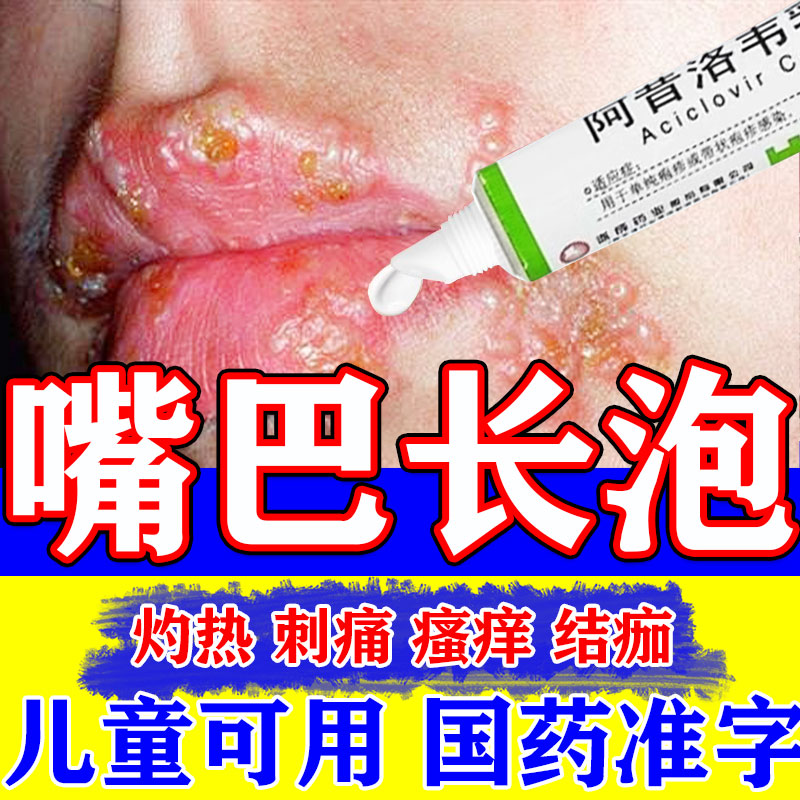 【韩都】阿昔洛韦乳膏3%*10g*1支/盒