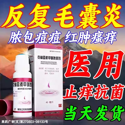 【天龙】克林霉素甲硝唑搽剂0.8%1%*40ml*1瓶/盒