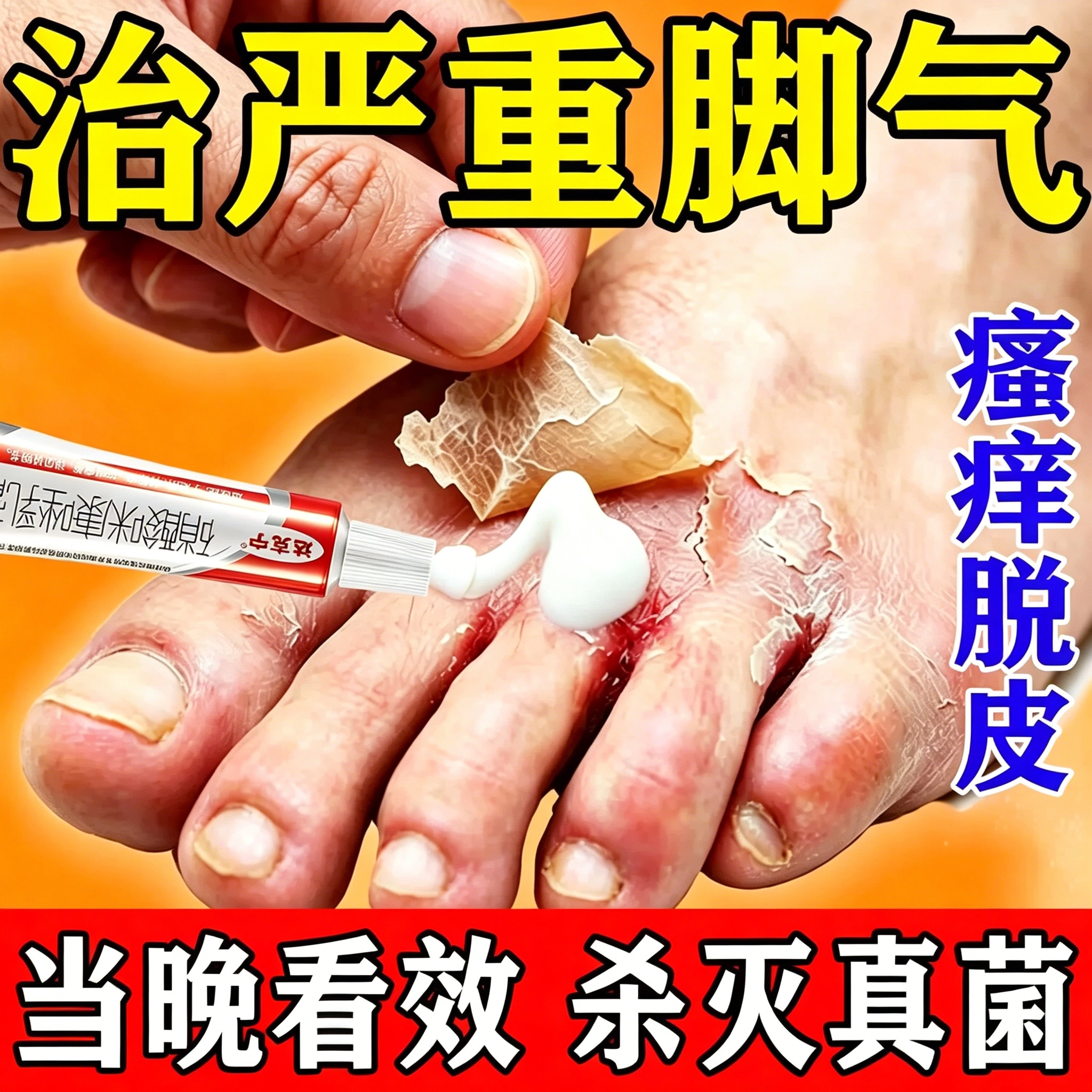 达克宁治脚气的官方旗舰店脚气止痒脱皮杀菌真菌感染专用硝酸咪康