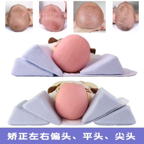 婴儿矫正定型枕宝宝纠正头型新生z儿侧睡枕防偏头尖头扁平头0-6-1