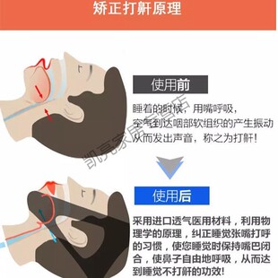 止鼾神器防止打鼾打呼噜鼻夹止鼾带阻鼾器止鼾器防呼噜成人呼噜消