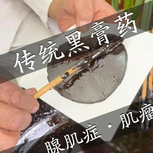 子宫肌瘤中药贴调理治疗卵巢囊肿消除的药内膜增厚息肉腺肌症痛经