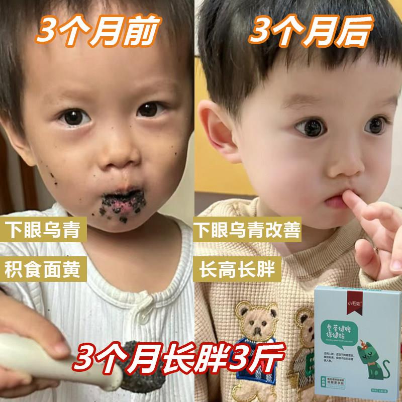 中药小儿脾胃贴虚腹胀肚子胀气健脾贴宝宝儿童养胃贴化食积长肉肉