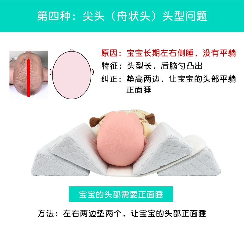 婴儿定型枕宝宝纠正头型枕新生儿侧睡枕防偏头尖头扁X平头舟状菱