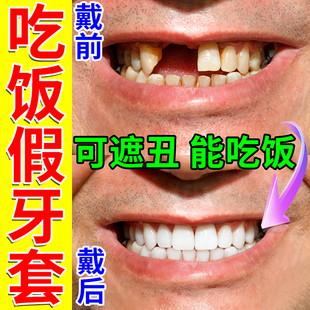 牙套通用吃饭神器成人非防磨牙夜间大人专通用缺蛀牙临时遮丑假牙