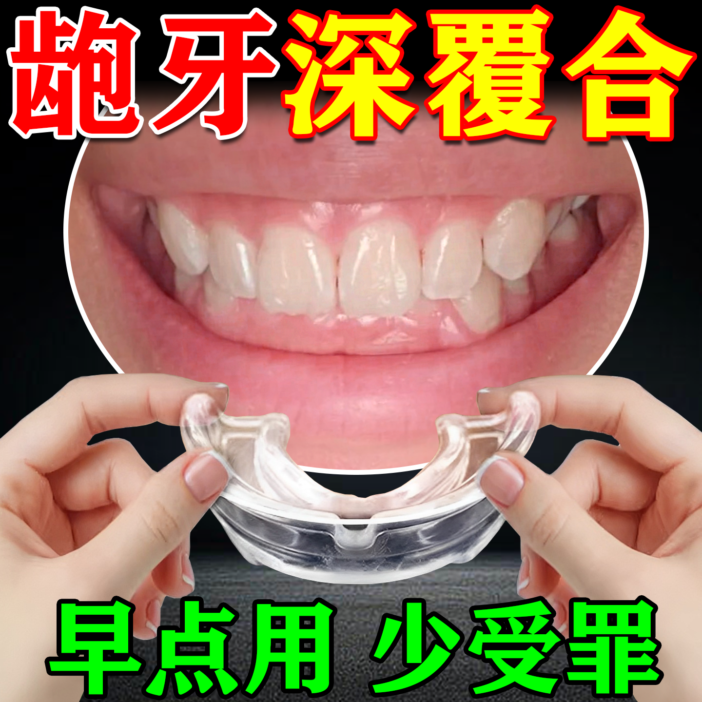 T0P.1深覆合矫正器,下巴反颚后缩