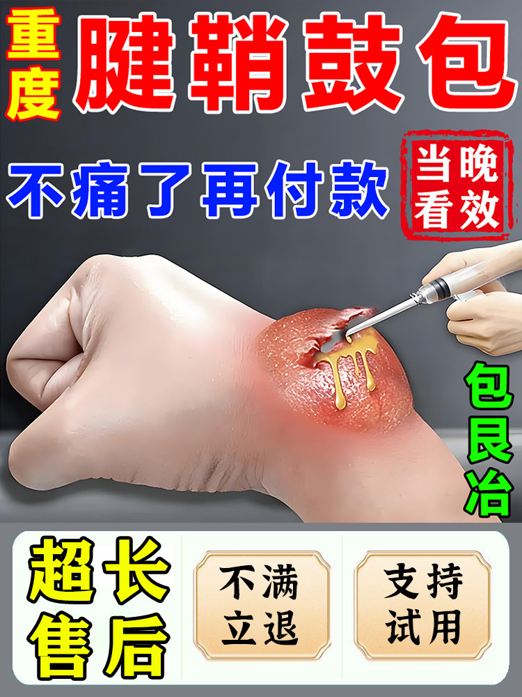 腱鞘囊肿鼓包专非用贴腱鞘疼护腕非治疗腱鞘炎手腕关节肿痛暖敷贴