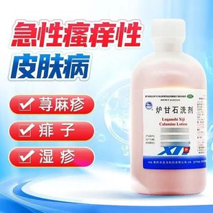 急性瘙痒皮肤病荨麻疹炉甘石洗剂外用涂抹湿疹痱子100ml