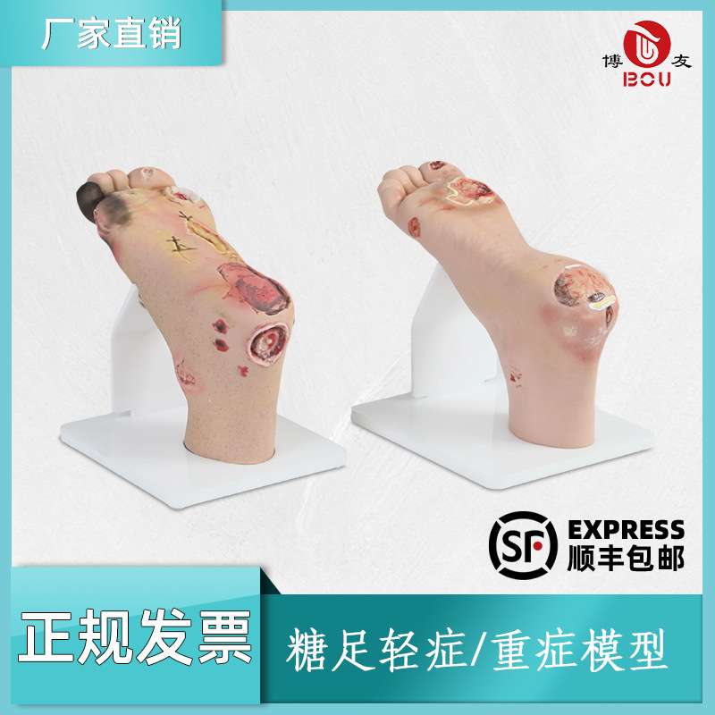 tnb足护理模型工具pvc模具老年人脚部训练设备hs19