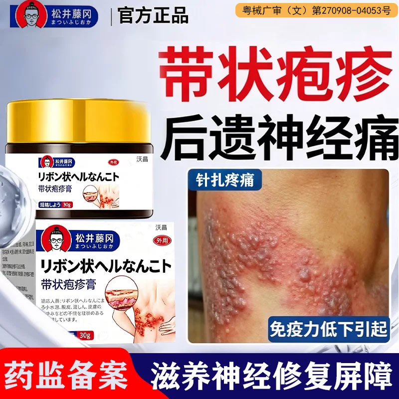带状疱疹后遗症神经痛特断进口专效i用药膏酶蛇盘疮修复外用hr