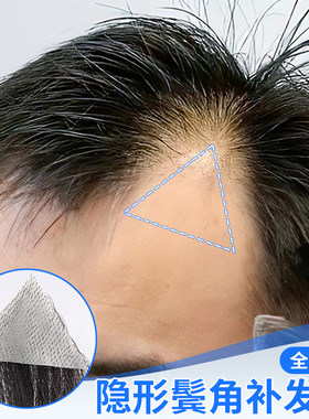 男士假浏海片鬓角补发假发片男女全真人发Lm型前额发际线假发贴片