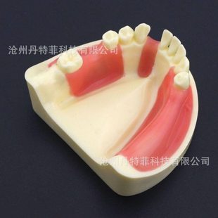 种植缺失模型 颌窦模型 下牙种植练习模型