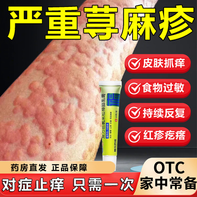 【福元】复方倍氯米松樟脑乳膏10g*1支/盒