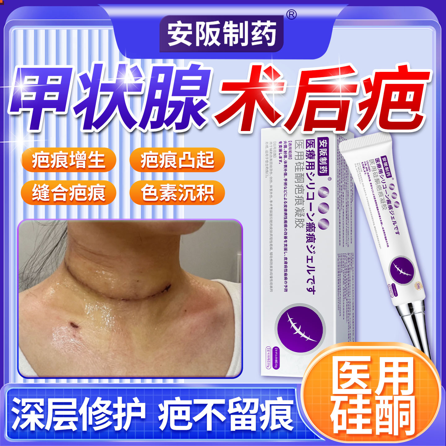 医用甲状腺术后疤痕硅酮凝胶增生凸起修复除疤膏减张贴遮挡神器sj