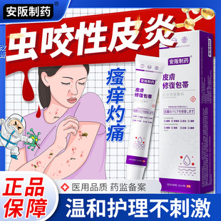 虫咬性皮炎丘疹性荨麻疹皮肤瘙痒毒虫蚊虫叮咬止痒消肿止痒膏sj