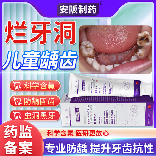 儿童防蛀牙龋齿修复医用含氟牙膏