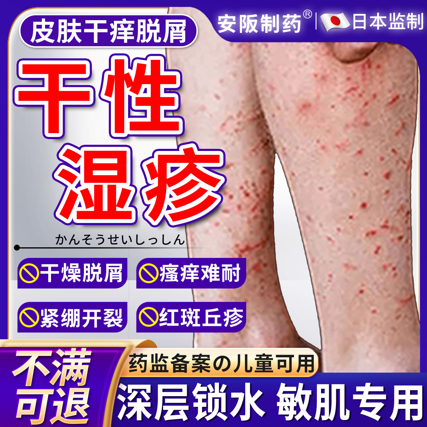 干性湿疹小腿秋冬天皮肤干燥瘙痒起皮专儿童顽固皮炎外用膏KY,医疗器械,保健理疗,淘宝优惠券,粉丝福利购,淘宝优惠卷