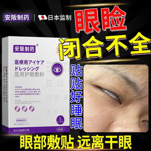 睡觉眼睛眼睑闭合不全贴暴露性角膜炎医用护眼贴干涩疼畏光流泪sj