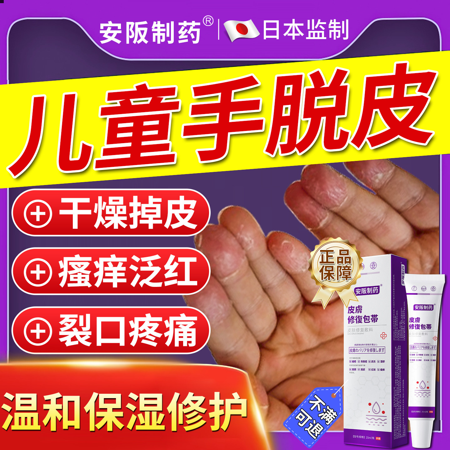儿童手指指尖脱皮药膏治疗小孩手癣膏干裂真菌感染专干燥起皮用ky