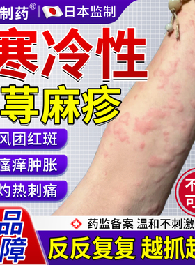 寒冷性寻荨麻疹过敏止痒特断风团效红斑根专快慢性用皮肤瘙痒药KY