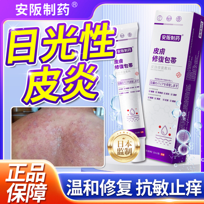 日光性皮炎紫外线过敏专皮肤晒伤用修复膏红斑瘙痒干燥起皮凝胶KY