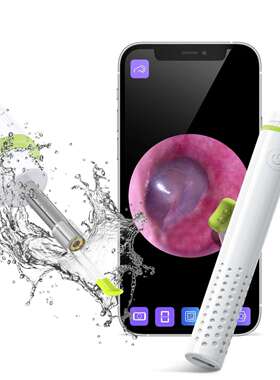 工厂智能发光耳勺SA39A挖耳朵采耳工具套装可视洁耳可视采耳