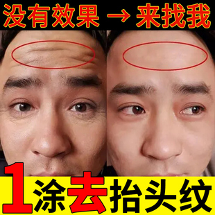 抬头纹去除消除神器男士抗皱紧致抗衰老面霜提拉去额头皱纹专用霜