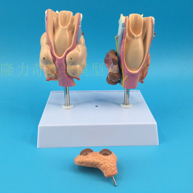 人体病理甲状腺模型 o甲亢甲低 内分泌系统医学解剖 甲状腺模型