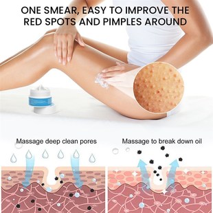 Chicken Skin Rough 3pcs Pore pilaris skin Spots Keratosis