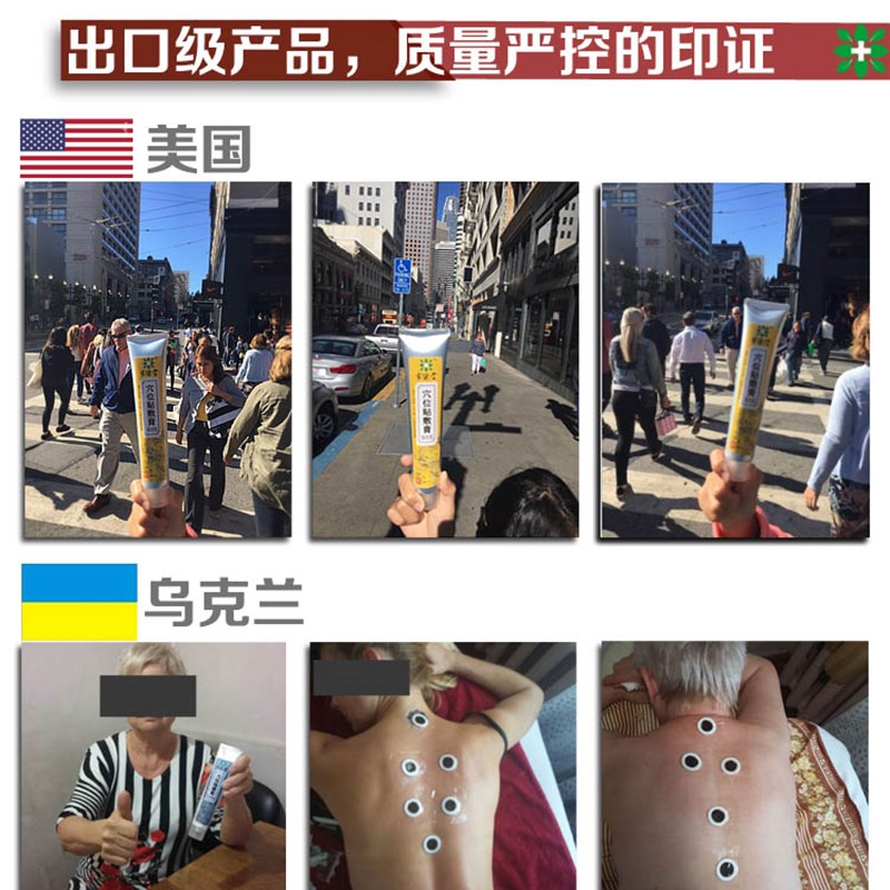 家德堂穴位贴敷膏三伏贴代针灸发热-省级医院技术-配方齐全