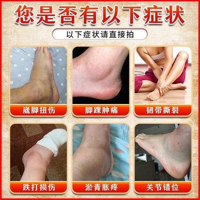 崴脚扭伤恢复药膏韧带拉伤跌打损伤活血化瘀舒筋消肿止痛专用贴膏
