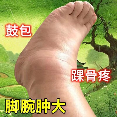 脚踝肿大疼痛专用药骨裂陈旧老伤关节肿大活血化瘀韧带拉伤药水