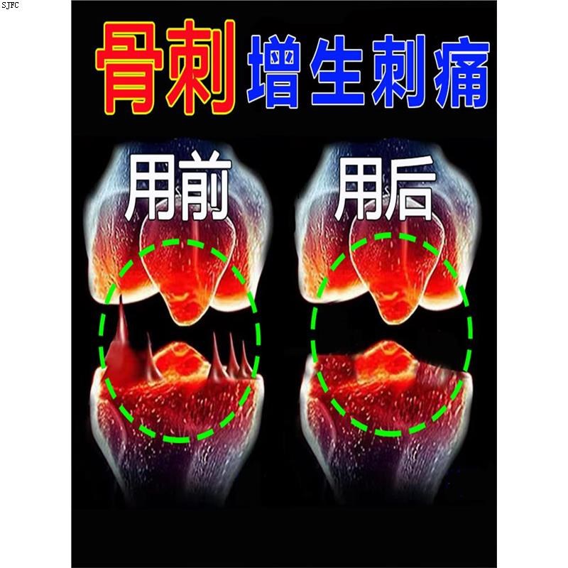 膝盖骨刺增生专用药膏走路足底关节红肿退行性麻木疼痛劳损草本贴