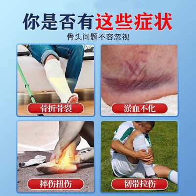 骨折骨裂恢复药快速接骨中老年韧带拉伤跌打活血化瘀舒筋消肿止痛