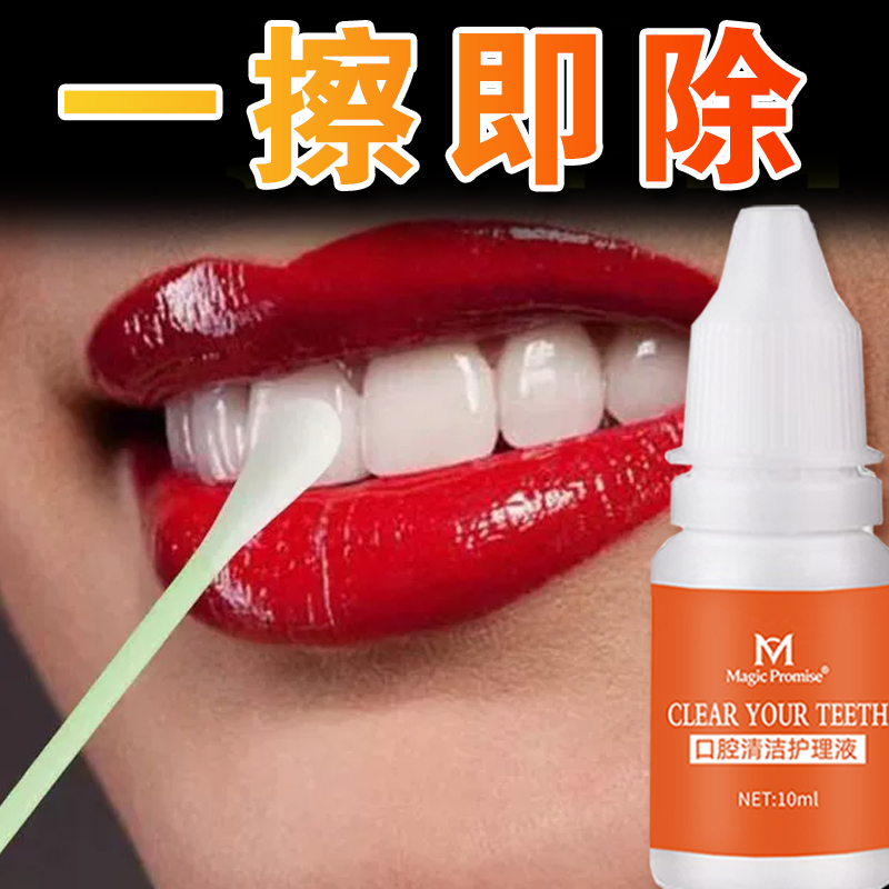 MagicPromise洗牙烟茶渍清洁牙垢除菌斑液速效神器正品官方旗舰店