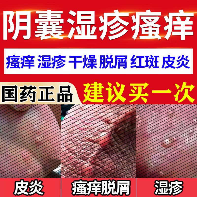 糠酸莫米松软膏乳膏阴囊潮湿瘙痒男人特药效湿疹止痒外用顽固皮炎