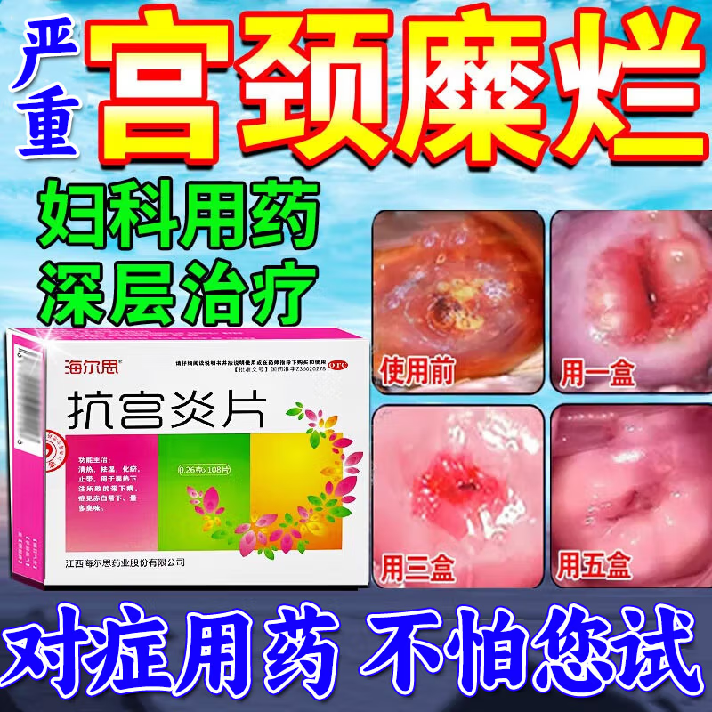 宫颈糜烂用药抗宫炎片官方旗舰店宫颈炎症专用中药妇科炎症消炎药