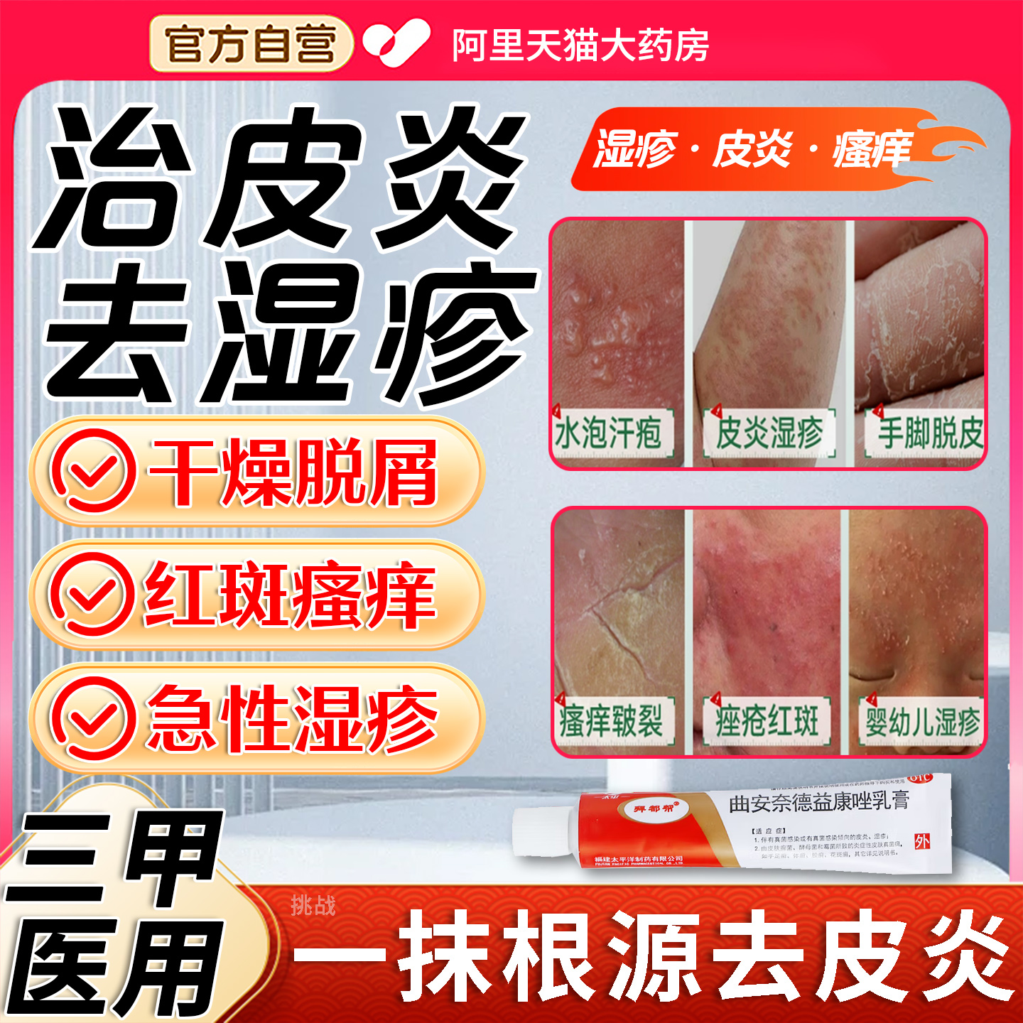 皮炎湿疹药膏汗疱疹止痒根外顽固皮肤瘙痒皮肤外用专治皮肤瘙痒JR