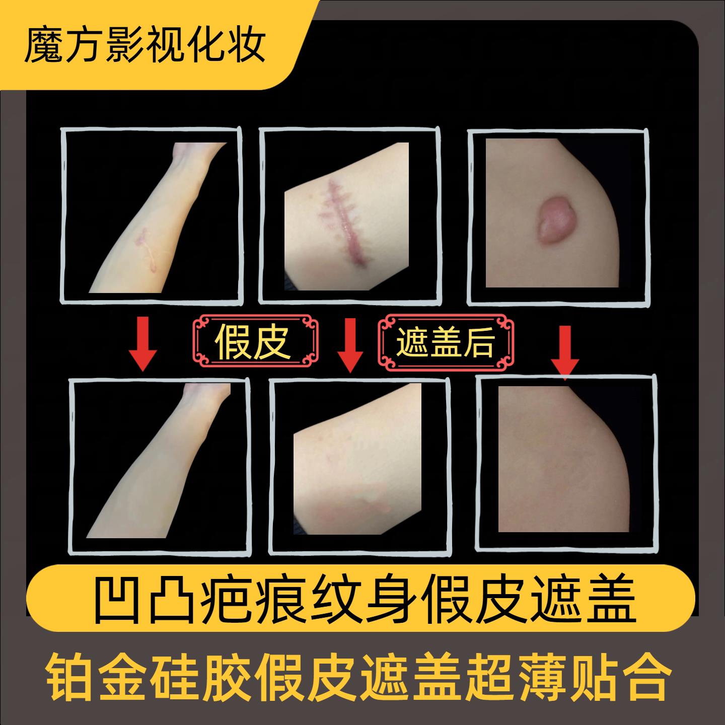 凹凸疤痕纹身铂金硅胶假皮遮盖超薄隐形贴合送试用皮疤痕遮盖假皮