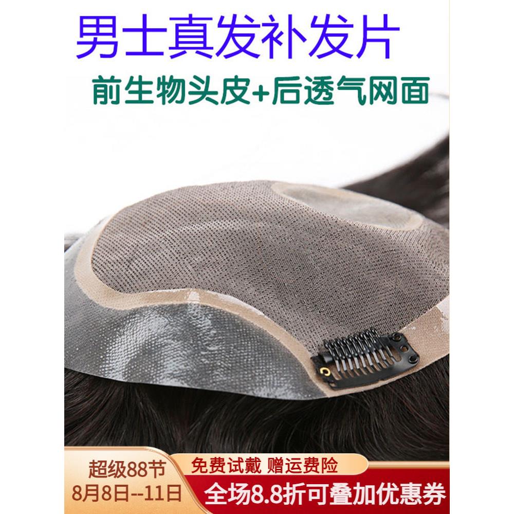 假发男头顶补发男真发短发帅气织发补发片男士秃顶前额发际线隐形