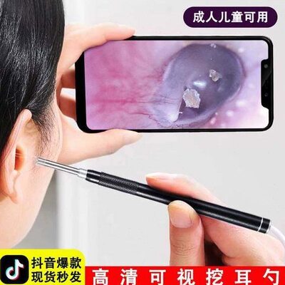 设备可视挖耳勺仪器专业掏耳朵神器高清镜采耳耳内道窥视镜检工具