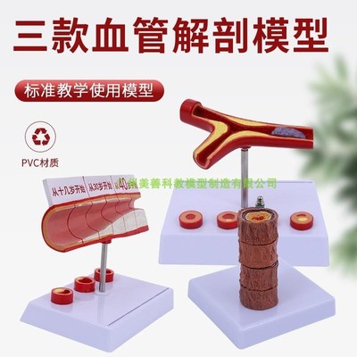 血管/堵塞动支脉k粥样/硬化K心血管动脉/硬化模型血管病理模型血