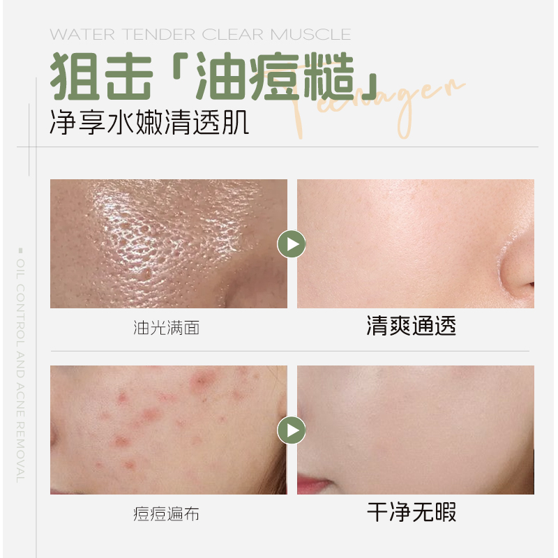 青少年祛痘氨基酸洁面乳