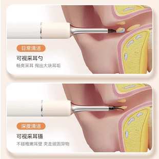 ?可视挖耳勺专业采耳镊子带夹子掏耳耵聍夹工具带灯儿童发光