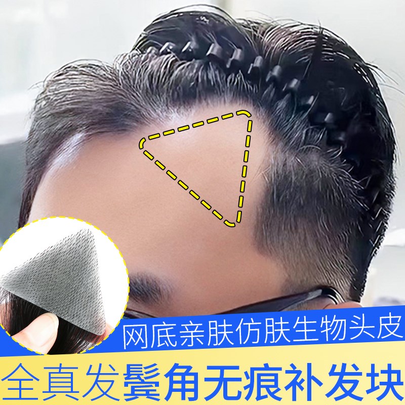 鬓角假发男女通用全真人发前额m型发际线无痕男士刘海片补发贴片图片